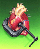 La Hipertensión Arterial - Un asesino Silencioso